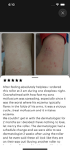 Load image into Gallery viewer, molluscum contagiosum FOR CHILD essential oil roller roll-on 10 ml topical treatment HealingOilsRN
